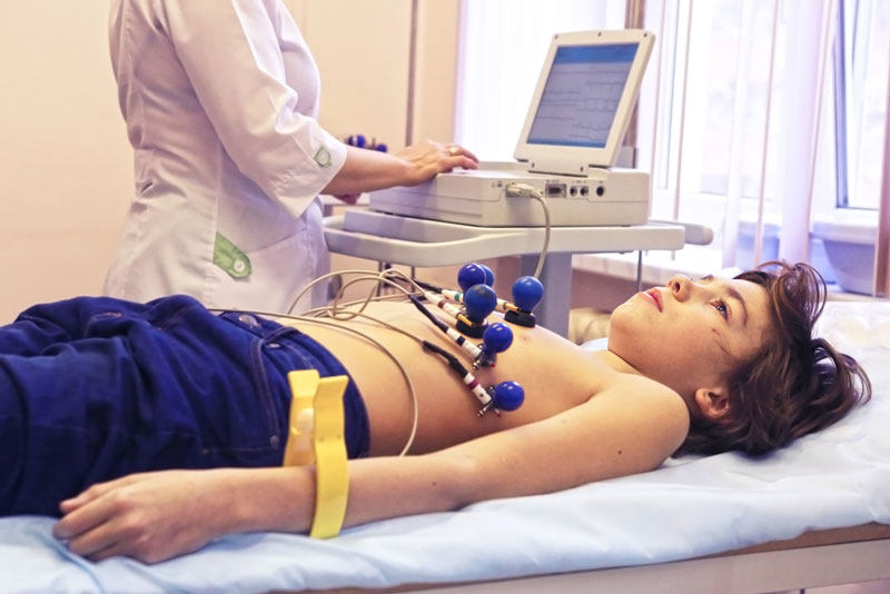 electrocardiogram